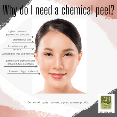 TCA Mineral Chemical Peel- Rolla Office